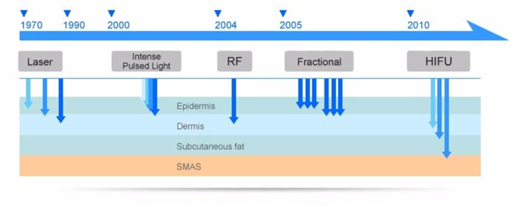 hifu machine for sale & hifu develop
