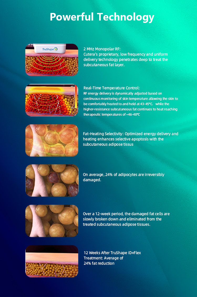 Trusculpt ID Reddit Trusculpt ID Stomach